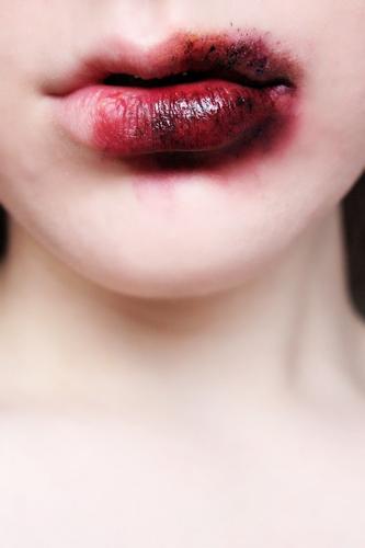 bleeding lips.jpg