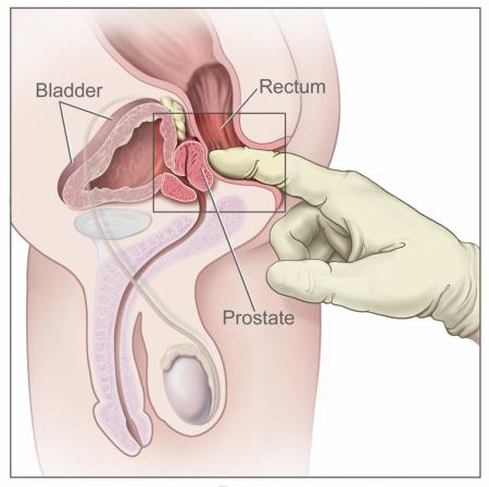 diagram-of-anus-and-prostate-anal-cancer-4.jpg